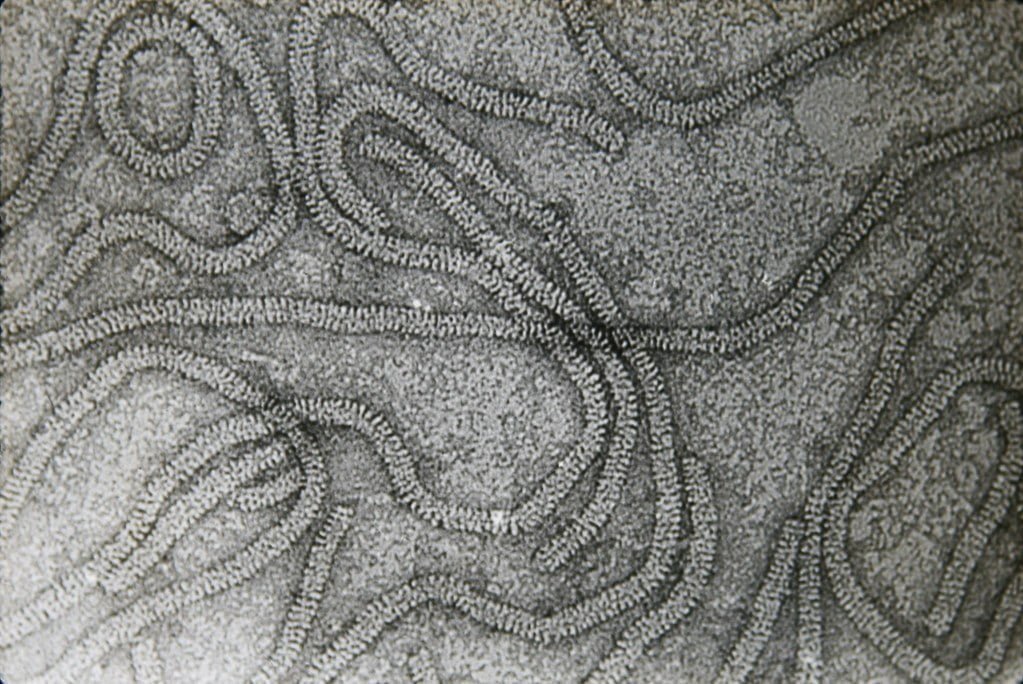 Citrus tristeza: transmision electron micrograph of CTV pa… | Flickr